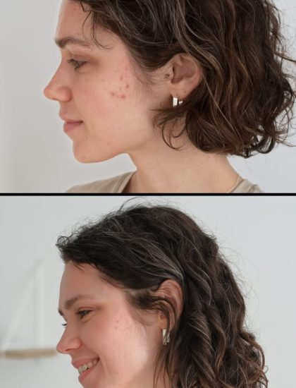 Before After - Geenu